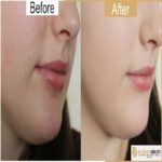 سرم روشن کننده AHA لنسیاد - تصویر 3