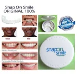 لمینت دندان Snap-On Smile