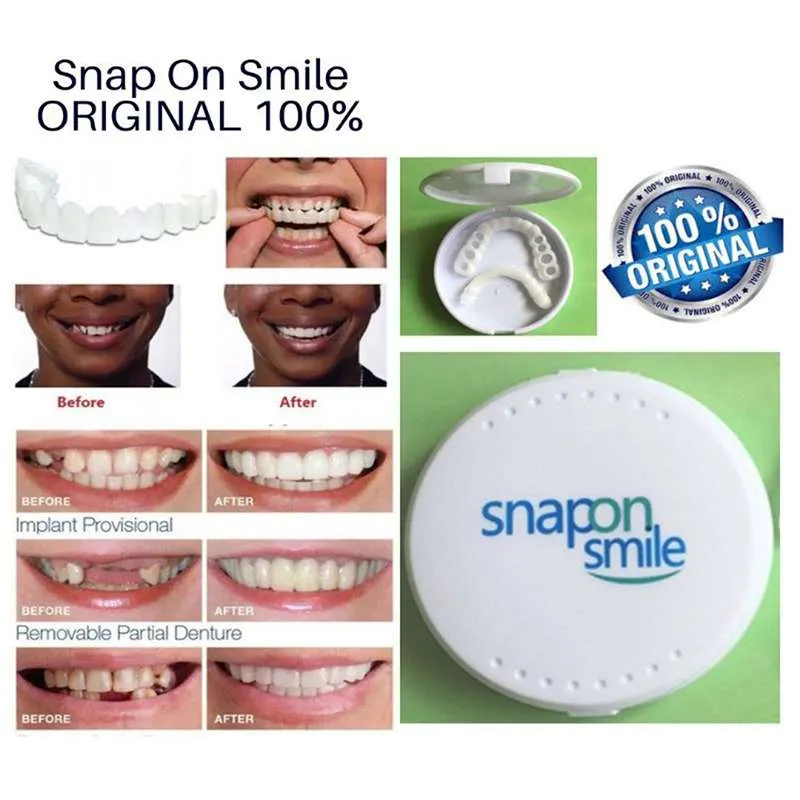 cf0d4ba0-eea3-450a-bd73-865948d9e428_20_11zon_15_11zon لمینت دندان Snap-On Smile - تصویر 1