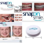 لمینت دندان Snap-On Smile - تصویر 3